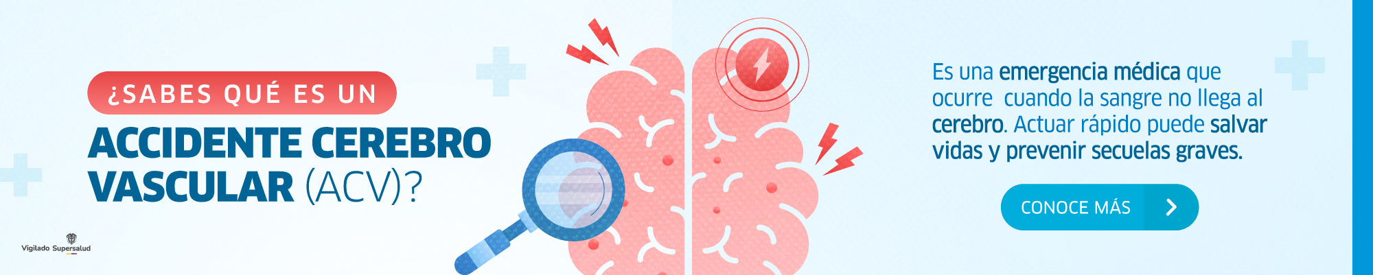 Accidente cerebro vascular Accidente cerebro vascular